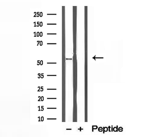 BCS1L Antibody