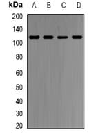 IHC-plus™ HMG-CoA Reductase / HMGCR Antibody