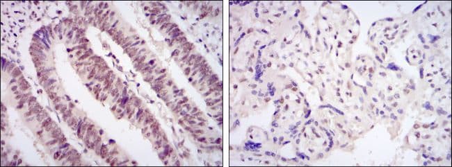 CDK9 Antibody (clone 1B5A7)