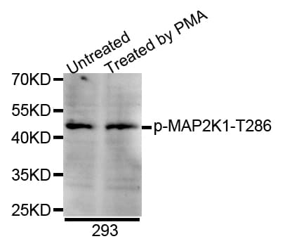 MAP2K1 / MKK1 / MEK1 Antibody (phospho-Thr286, AP)