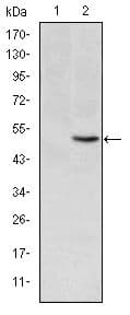 Monoclonal Mouse anti-Human MTHFR Antibody (clone 5D3, IHC, WB)