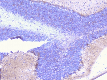 PCDH15 Antibody