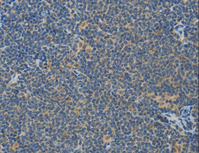 Polyclonal Rabbit anti-Human ASPA Antibody (IHC, WB)