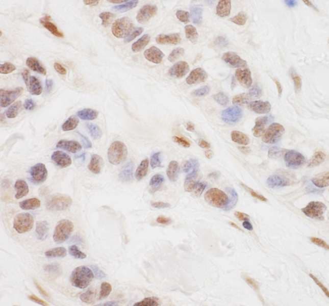 CRTC3 Antibody (aa569-619)