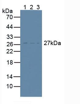 Polyclonal Rabbit anti-Human CD81 Antibody (aa113-201, WB)
