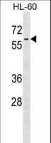 Polyclonal Rabbit anti-Human LIN9 Antibody (aa132-160, WB)