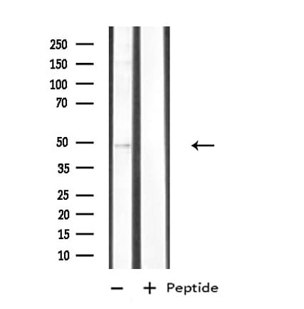 CSNK1D Antibody