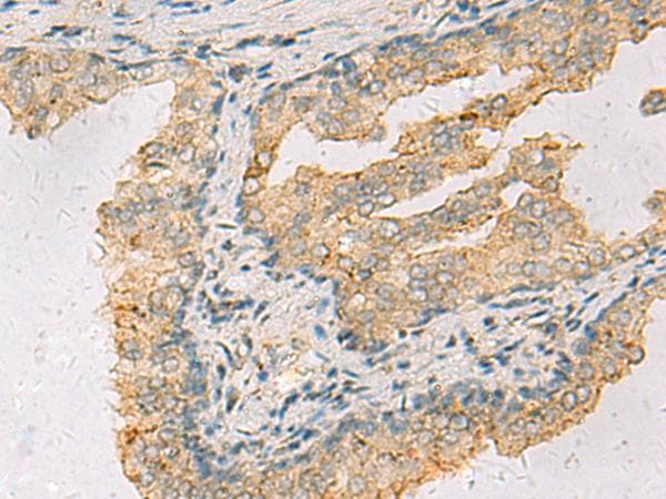 ANXA13 / Annexin XIII Antibody