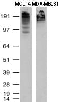 MKI67 / Ki67 Antibody (aa1160-1493, clone UMAB107)