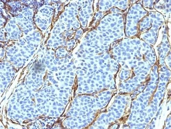 Monoclonal Mouse anti-Human NGFR / CD271 / TNR16 Antibody (clone SPM299, IHC, IF)