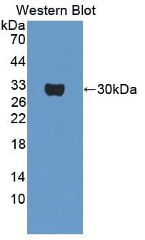 OS9 Antibody