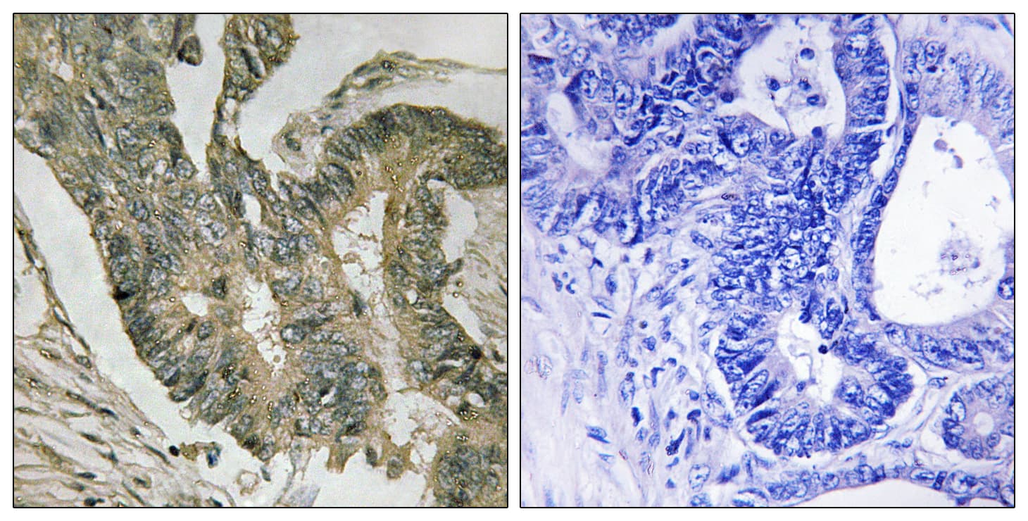 ALDOC / Aldolase C Antibody (aa61-110)