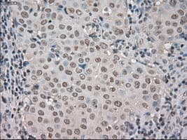 BUB1B / BubR1 Antibody (clone OTI3C7)