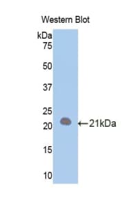 CD118 / LIF Receptor Alpha Antibody (aa641-790, Biotin)