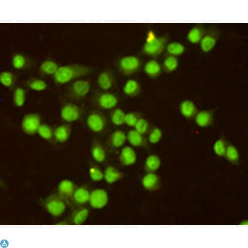 RPA2 / RFA2 / RPA34 Antibody