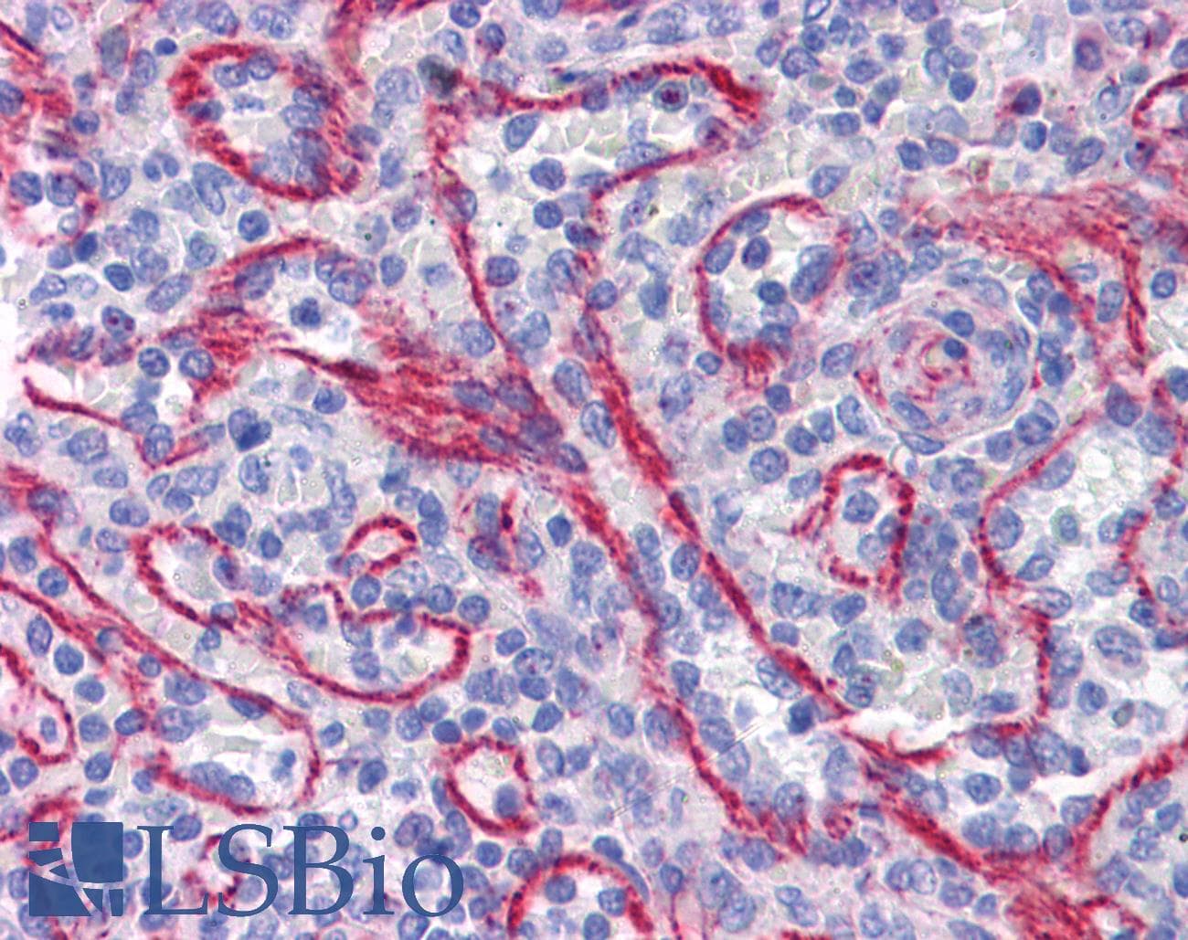 IHC-plus™ STAU1 / Staufen Antibody