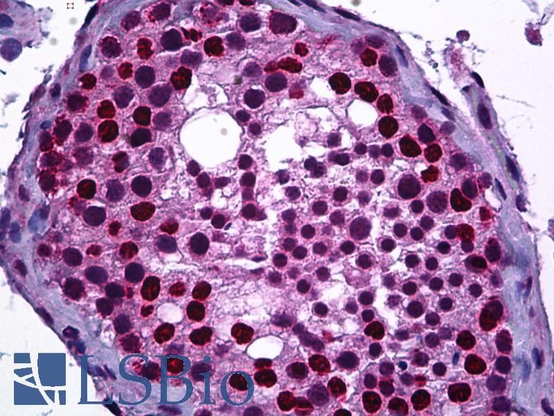 IHC-plus™ Polyclonal Rabbit anti-Human DNMT3B Antibody (aa1-50, IHC, IF, WB)