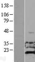 ADI1 / ARD Protein (Over-Expression Lysate Myc-DDK (Flag))