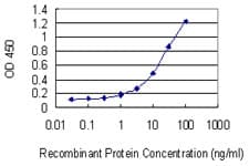 Monoclonal Mouse anti-Human DSPG3 / Epiphycan Antibody (clone 2G6, WB)