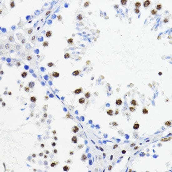 ZEB1 / AREB6 Antibody