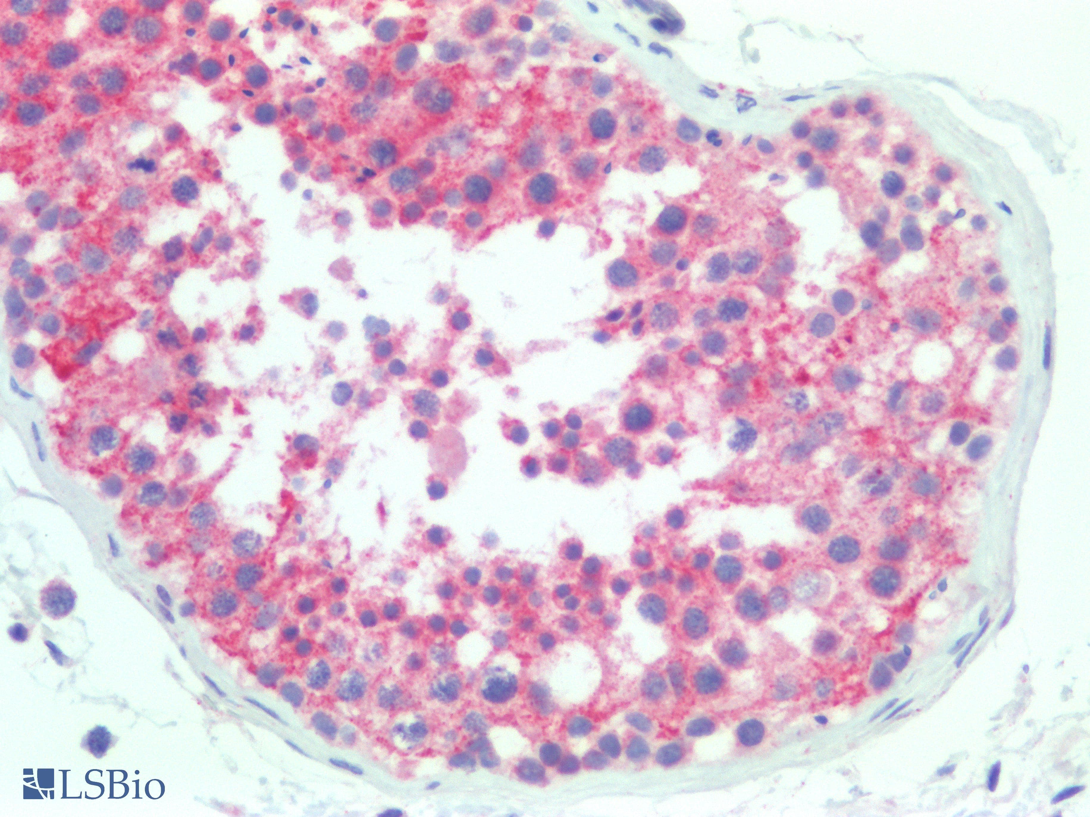 PathPlus™ RAB11A Antibody (clone 1565CT164.36.80)