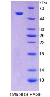 Human SCNN1A / ENaC Alpha Protein (Recombinant His-T7)