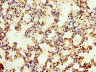 MFSD11 / ET Antibody