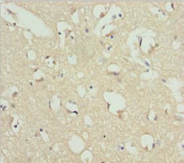 Polyclonal Rabbit anti-Human REEP1 Antibody (IHC, WB)