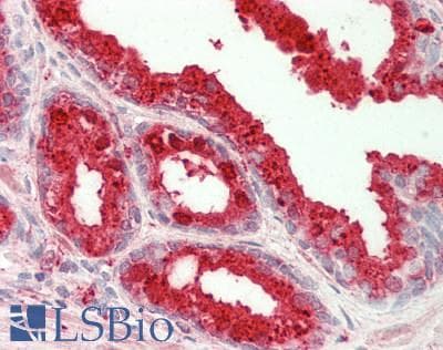 PSAP / Prosaposin Antibody (FITC)