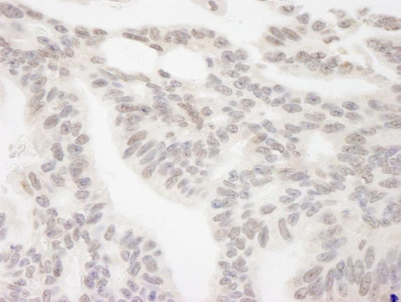 RBM12 Antibody (aa625-675)