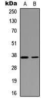 NEIL2 Antibody (Internal)