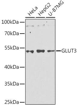 SLC2A3 / GLUT3 Antibody