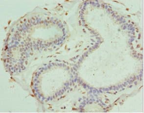PDXK / PNK Antibody