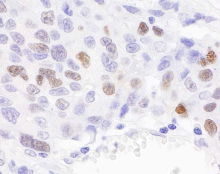 KPNA2 / Importin Alpha 1 Antibody (aa1-50)