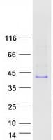 Human ACRV1/Intra-Acrosomal Protein (Recombinant Myc-DDK (Flag))