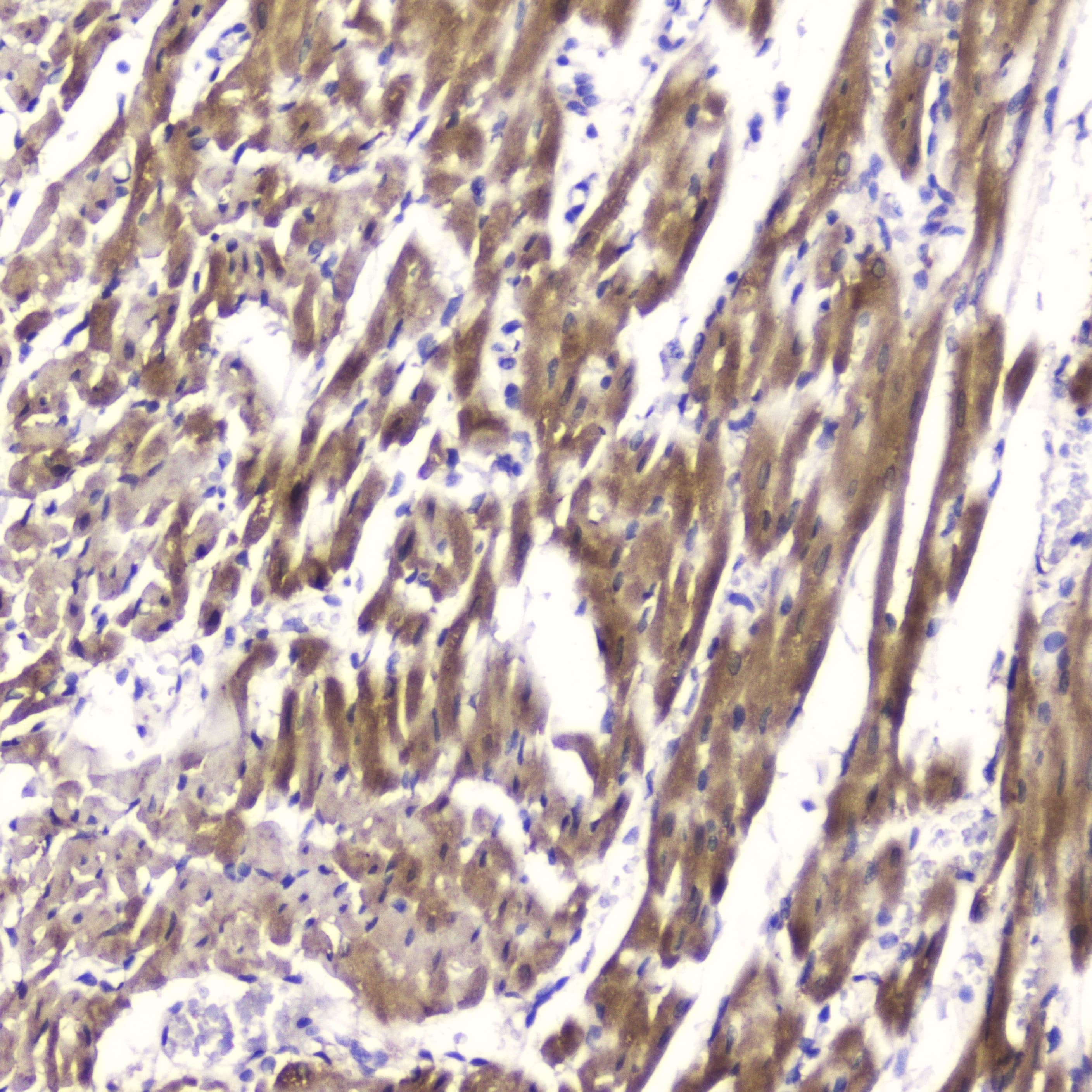 FABP3 / H-FABP Antibody
