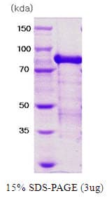 Human PRMT1 Protein (Recombinant His)