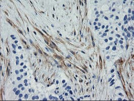Monoclonal Mouse anti-Human CNN2 Antibody (clone OTI2B5, IHC, IF, WB)