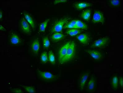 Polyclonal Rabbit anti-Human CD99L2 Antibody (IHC, IF)