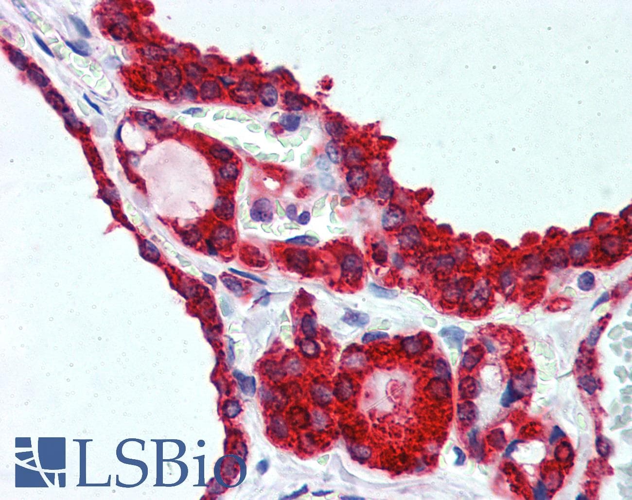 IHC-plus™ WNT5A Antibody (clone 6F2)