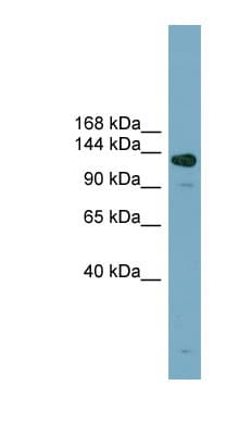 Polyclonal Rabbit anti-Human ASXL2 Antibody (aa575-624, WB)