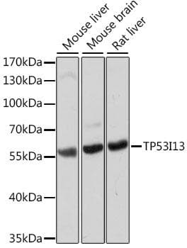 Polyclonal Rabbit anti-Human TP53I13 Antibody (IF, WB)
