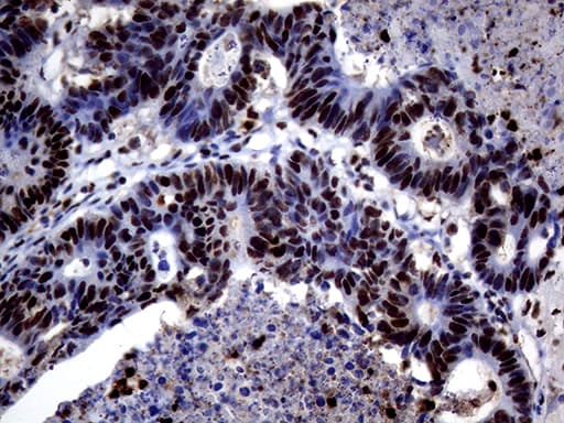 TALDO1 / Transaldolase 1 Antibody (clone OTI1A5, Carrier-free)