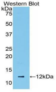 CCL5 / RANTES Antibody (aa24-91, Cy3)