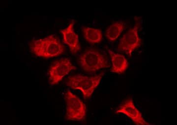 TAS2R20 / TAS2R49 Antibody