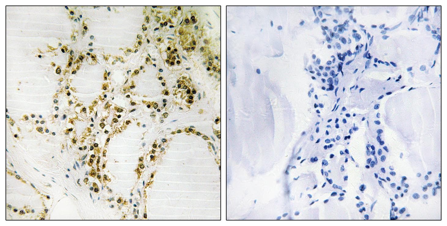 EP300 / p300 Antibody (phospho-Ser89)