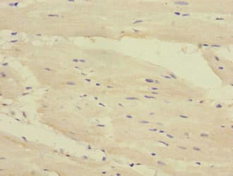 DSC1 / Desmocollin 1 Antibody