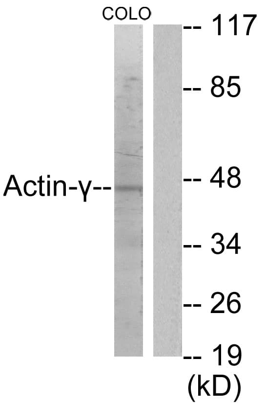 PathPlus™ ACTG2 Antibody (aa1-50)