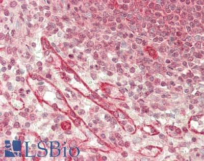 CHID1 Antibody (N-Terminus)