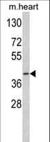 MCAD / ACADM Antibody (aa189-217)